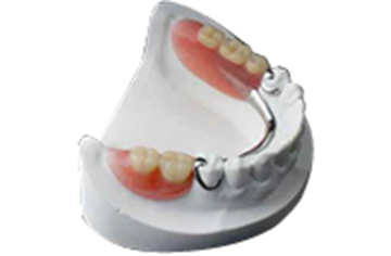 義歯（入れ歯）の定期検診について
