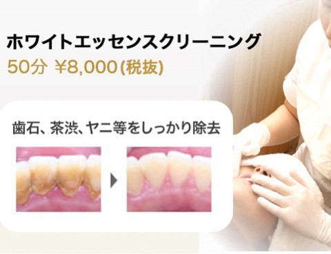 {4D889123-863D-4F92-8E83-1DB31F1928D2}